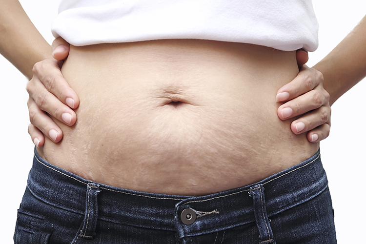 We’ve all been in the situation where we're stuck with those stubborn last pounds of belly fat. We’ve discovered there could be a few factors contributing to the extra fat on your belly without you even realizing it!